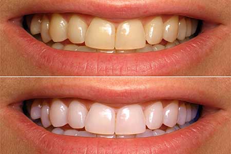 estetica-dentara-vef-dent--