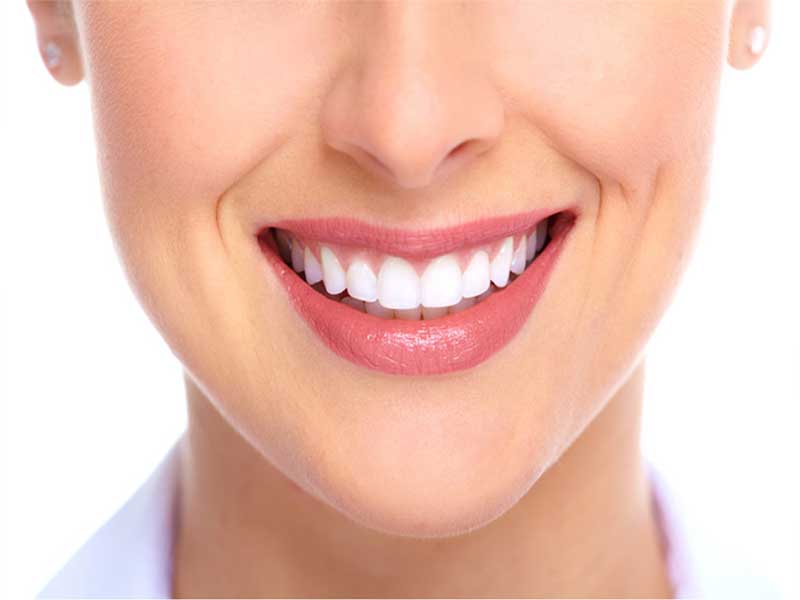 estetica-dentara-vef-dent